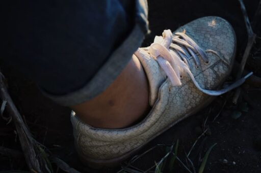 how to stop shoes from blistering